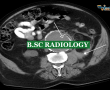 BMRIT – Bachelor of Medical Radiology